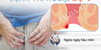 4-cap-do-tri-ngoai-cap-bao-nhieu-thi-nguy-hiem-xem-ngay-truoc-khi-muon