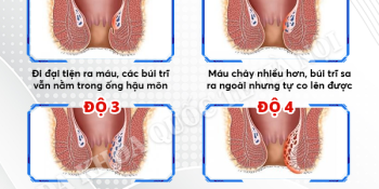 dang-bi-tri-noi-kiem-tra-ngay-de-biet-ban-thuoc-cap-do-nao