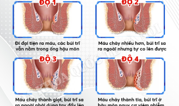 dang-bi-tri-noi-kiem-tra-ngay-de-biet-ban-thuoc-cap-do-nao