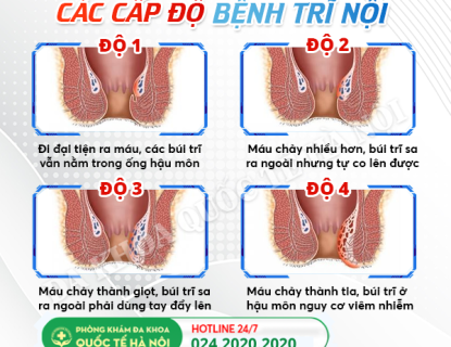 dang-bi-tri-noi-kiem-tra-ngay-de-biet-ban-thuoc-cap-do-nao