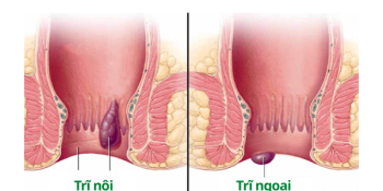 tri-noi-va-tri-ngoai-khac-nhau-the-nao-dua-vao-dau-de-nhan-biet