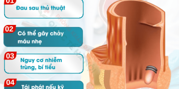 cac-phuong-phap-dieu-tri-tri-noi-hieu-qua-hien-nay