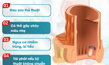 cac-phuong-phap-dieu-tri-tri-noi-hieu-qua-hien-nay